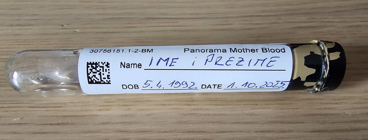 Označavanje epruvete